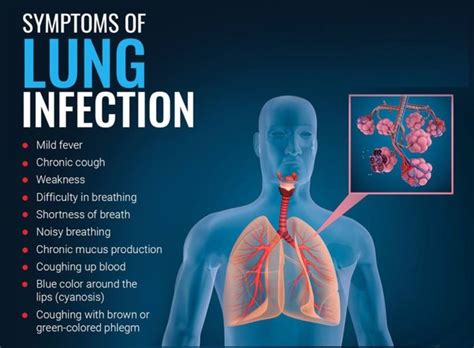 white lung infection symptoms